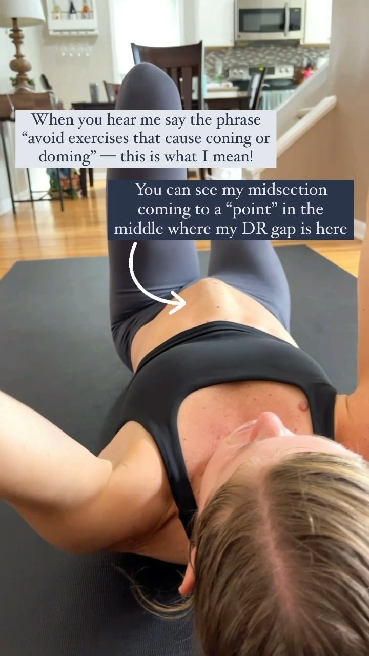 Diastasis recti, does a doming stomach mean you should stop the exercise?  - Healthy Post Natal Body