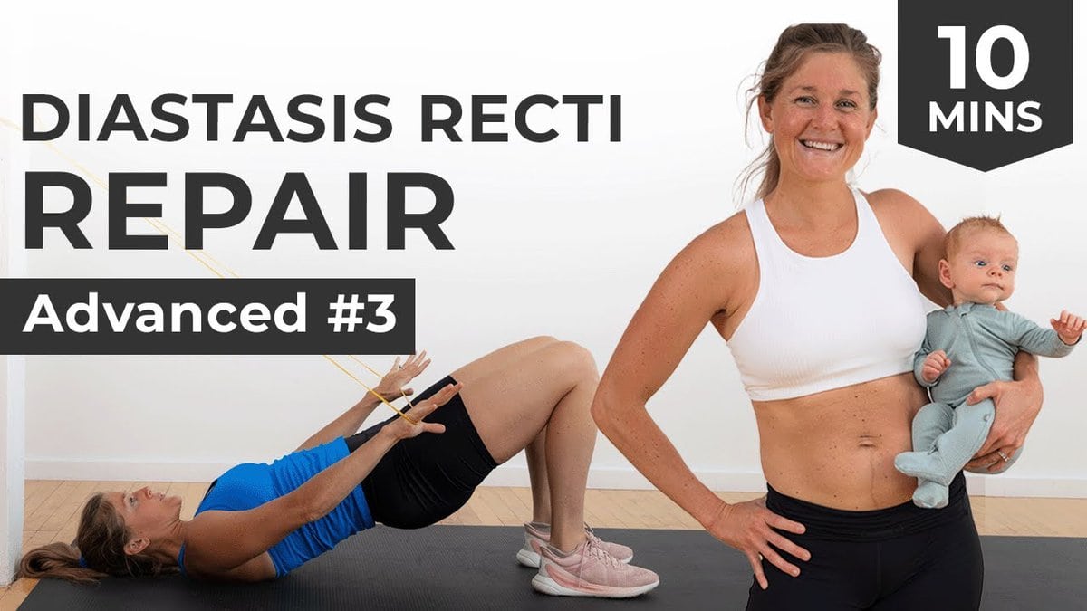 5-MINUTE DIASTASIS RECTI EXERCISES: 5-Day Workout Program to fix Diastasis  Recti, Heal Abdominal separation and close your Postpartum Gap.: PAUL,  ALICE: 9798837888823: : Books